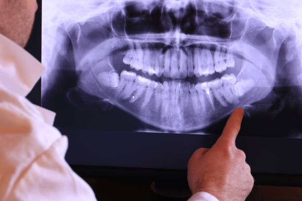Best Emergency Dental Care for Broken or Chipped Teeth in Green Valley, MD