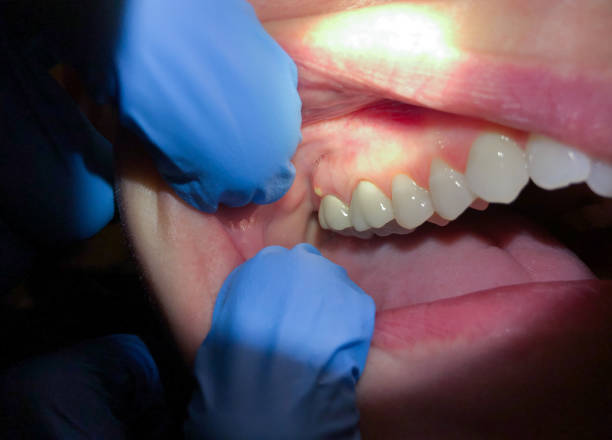 Best Pediatric Emergency Dentist in Green Valley, MD